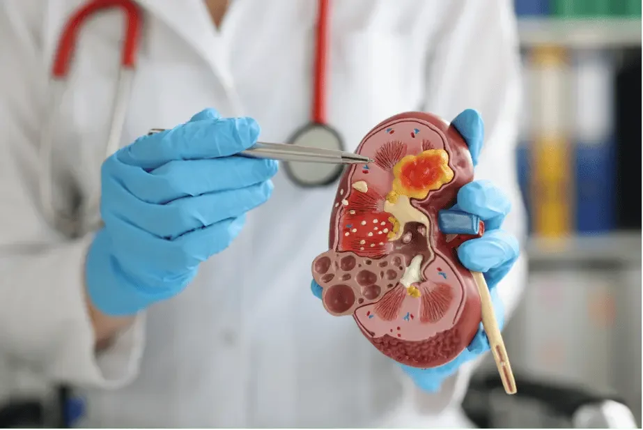 Urinary Tract Infections (UTI)