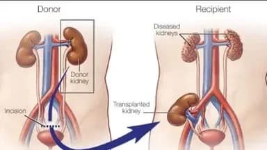 Pre & Post Kidney Transplant Guidance
